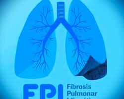 Fibrosis Pulmonar Idiopática FOTO: WEB